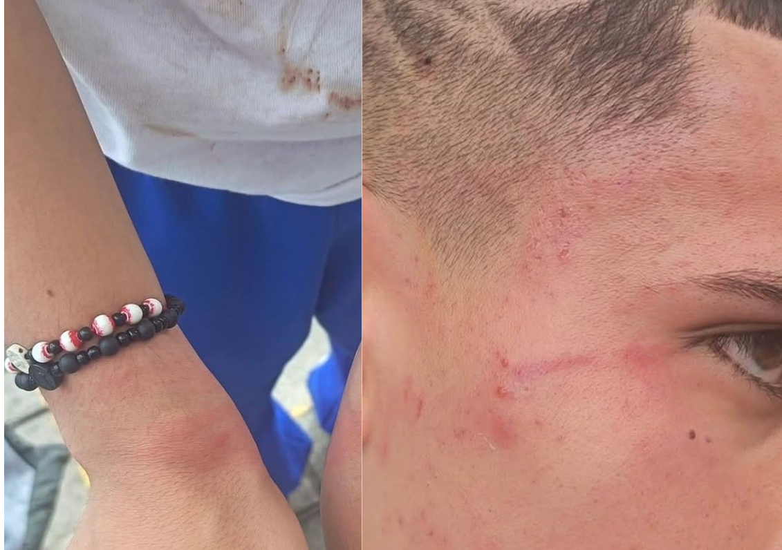 Menor denuncia agresiones en un CAI de Suba tras ser señalado de un apuñalamiento