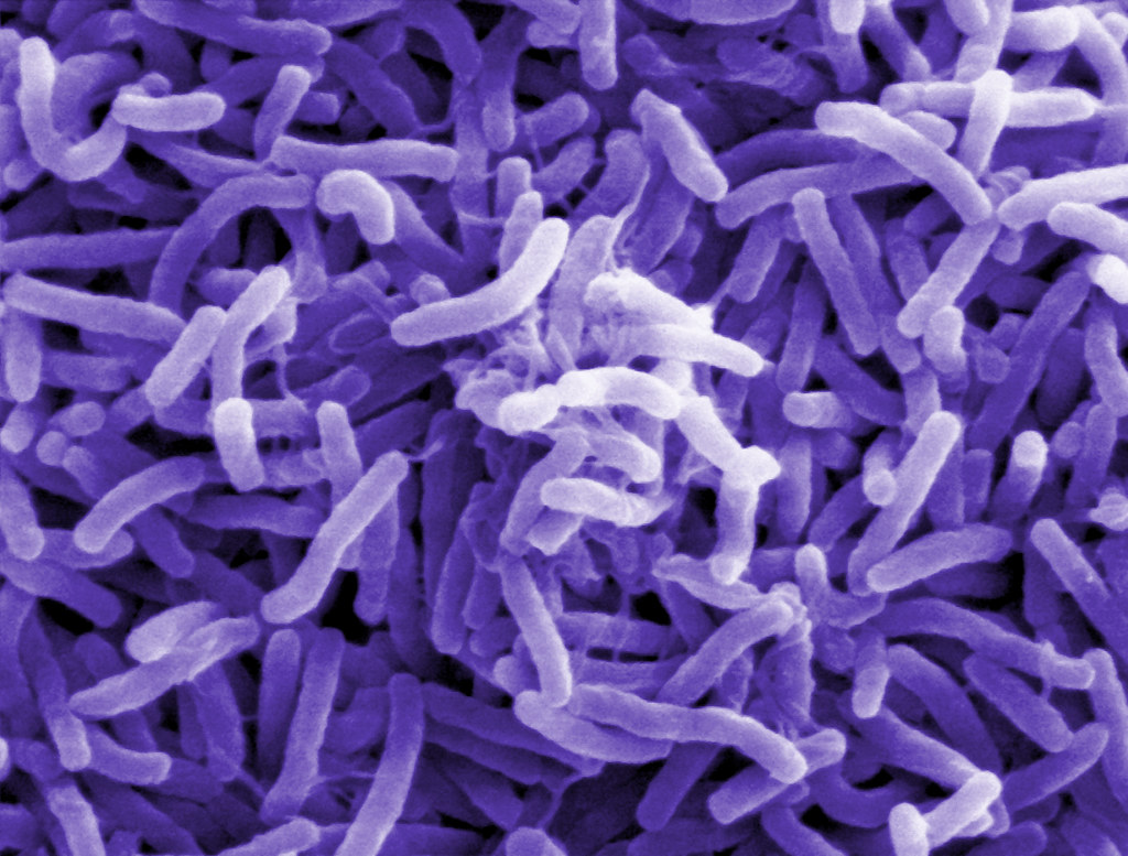 El informe que muestra la relación de la contaminación con las “superbacterias”