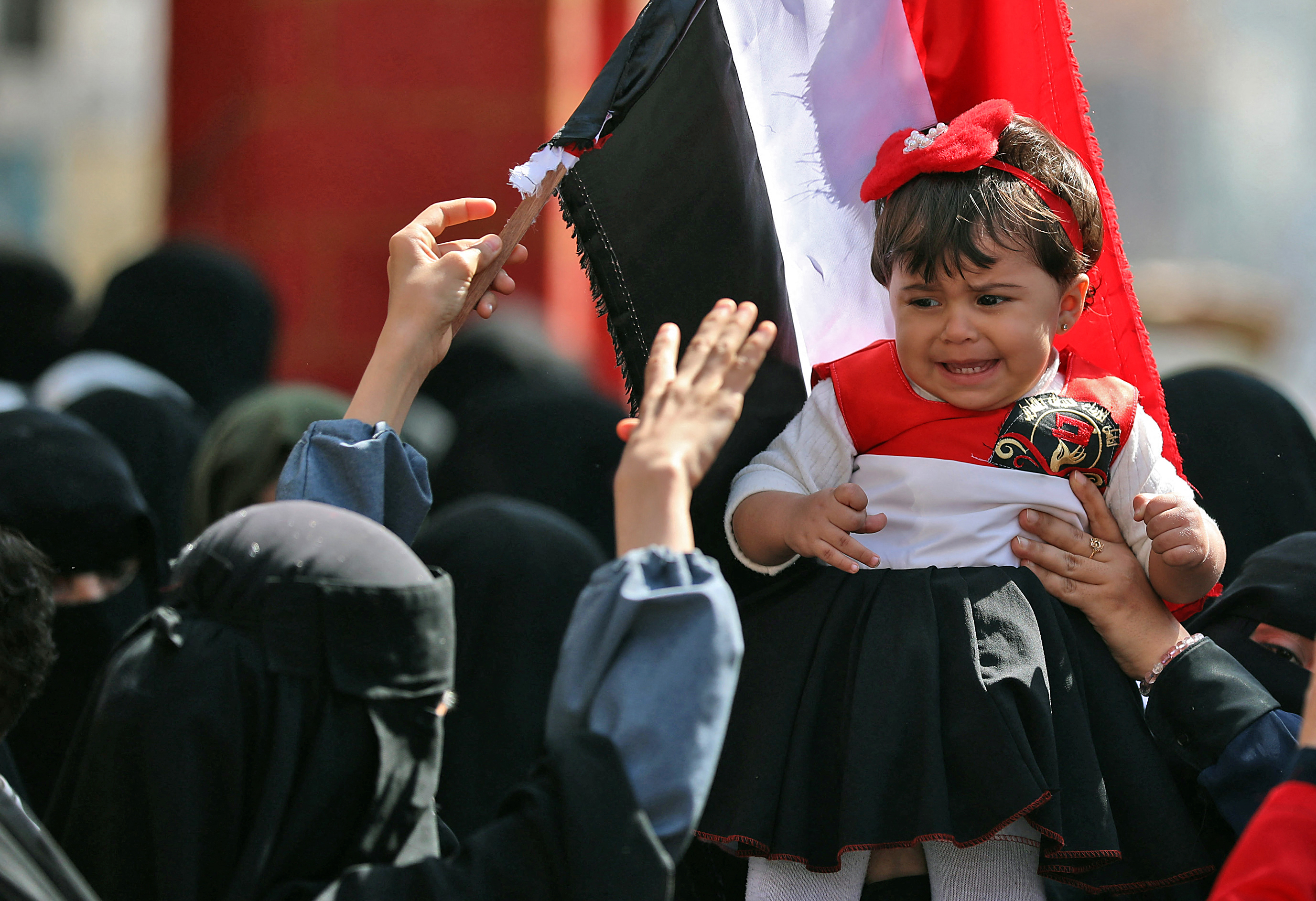 La mitad de los niños de Yemen sufrirán malnutrición en 2021, alerta la ONU