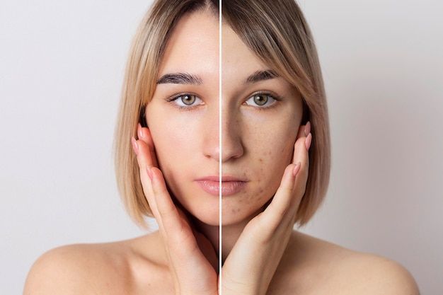 ¿Cómo quitar las manchas de la cara? Esta es la formula con bicarbonato y miel