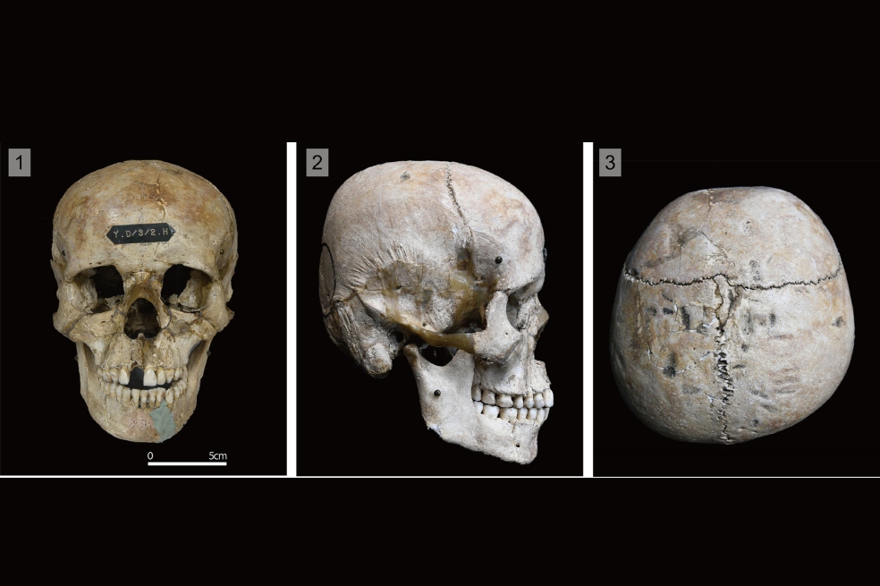 En este pueblo de Japón deformaban cráneos de bebés hace 1.800 años, ¿por qué?