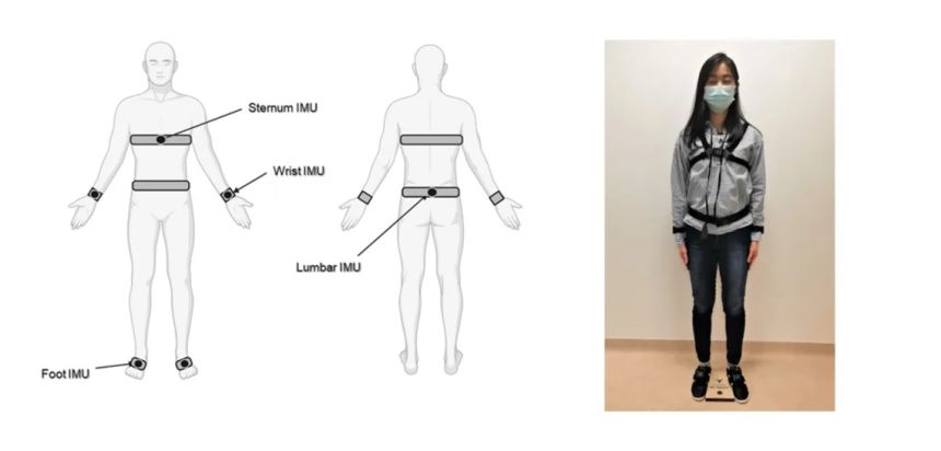 Estos sensores podrían rastrear mejor el avance del Parkinson que la observación humana