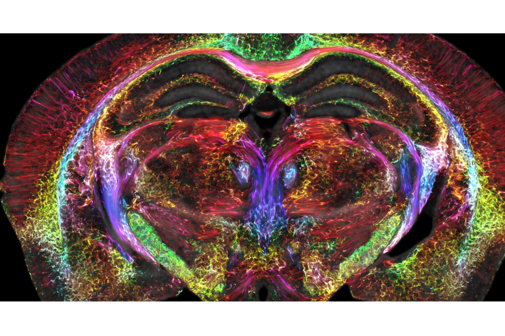 Captaron imágenes cerebrales 64 millones de veces más nítidas que las usuales
