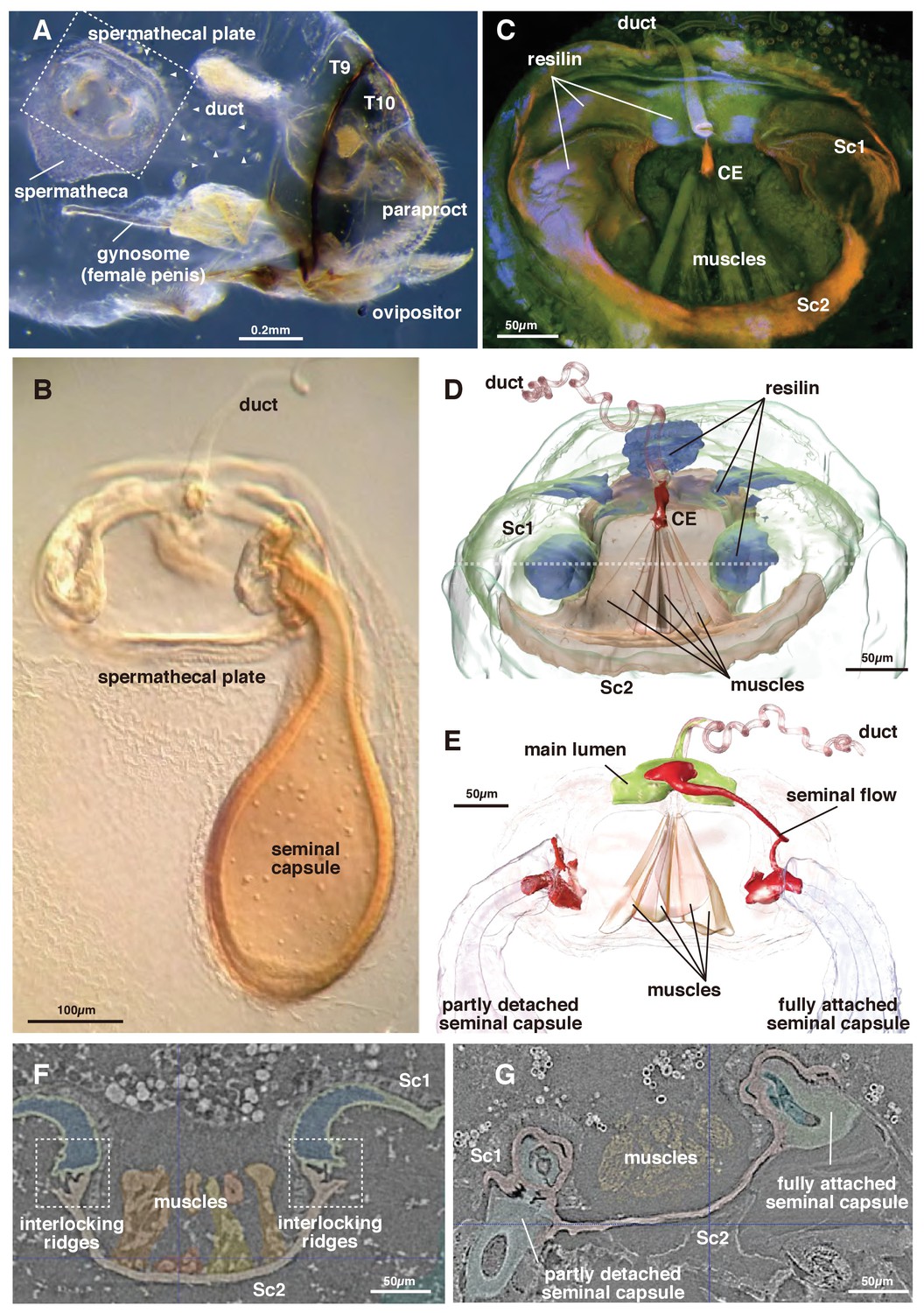 Morfología de la espermateca y placa espermatecal de Neotrogla.eLife MagazineGracias al análisis con microscopía óptica, de láser confocal y tomografía computarizada de alta resolución del órgano, los investigadores descubrieron una pequeñaválvulade cambio de 0,3 mm de ancho en la entrada del órgano de almacenamiento de semen.