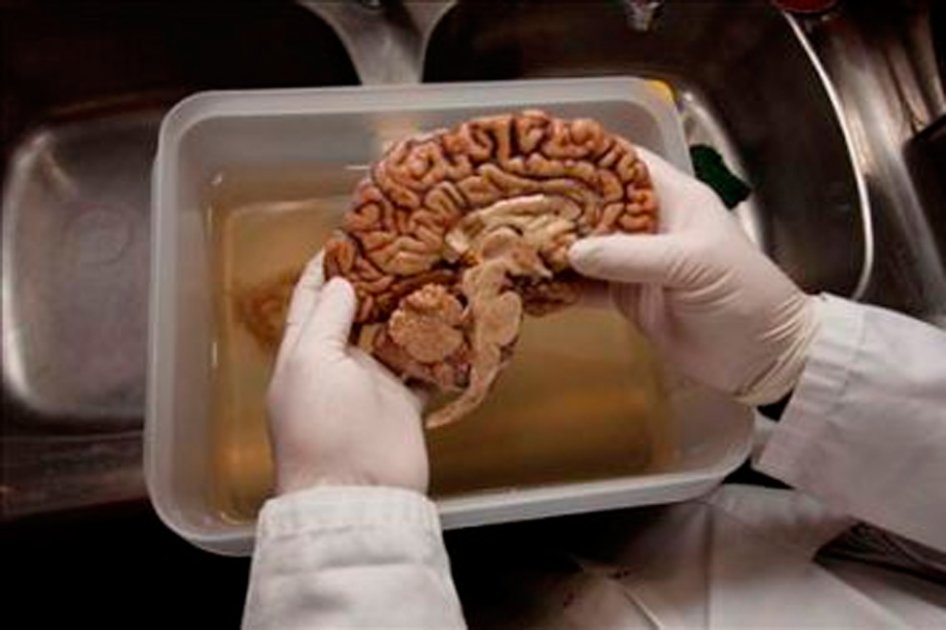 Hallan cerebros, partes de pulmones y corazones en un depósito en EE.UU.