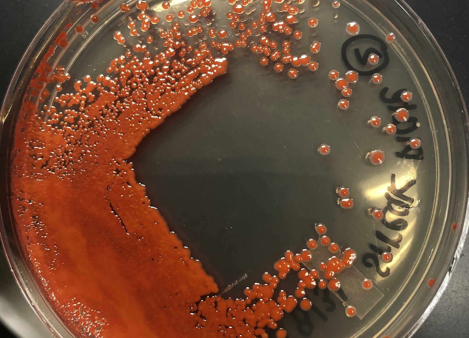 Imagen de la bacteria "Serratia marcescens" en una caja de petri.