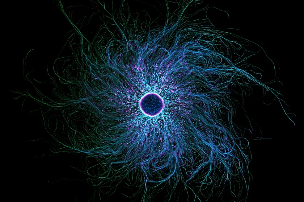 El séptimo puesto de la competencia fue para Stella Whittaker, quien capturó a una serie de neuronas sensoriales derivadas de iPSC, marcadas para mostrar tubulina y actina.