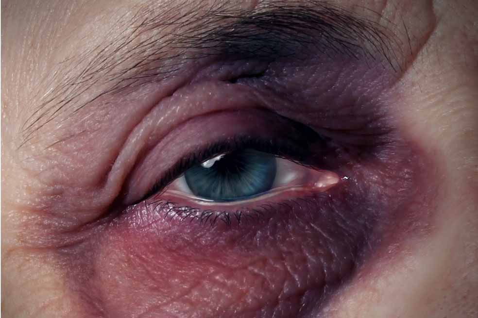1.257 ancianos maltratados en Colombia