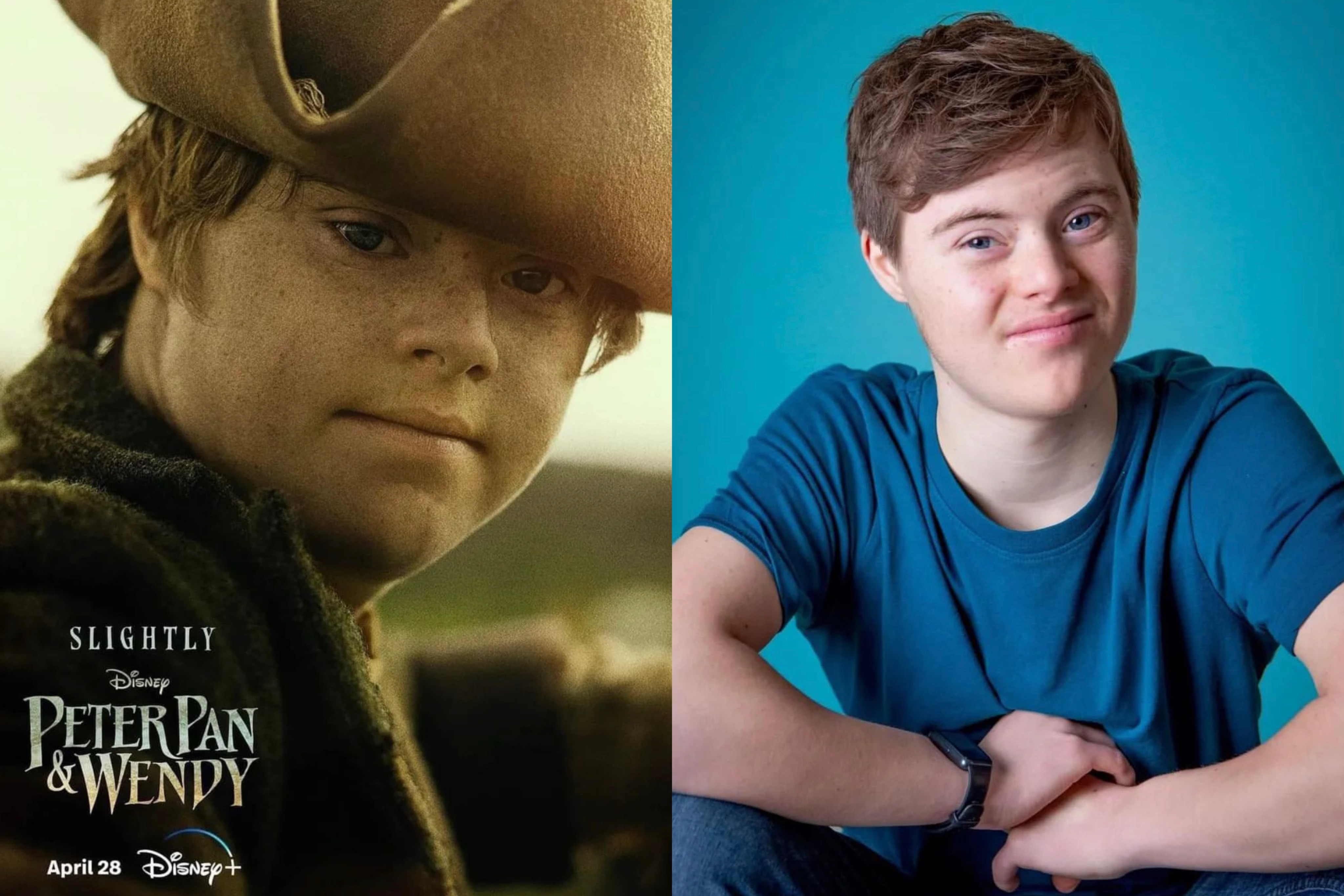 Peter Pan live action tendrá un actor con síndrome de Down, ¿de quién se trata?