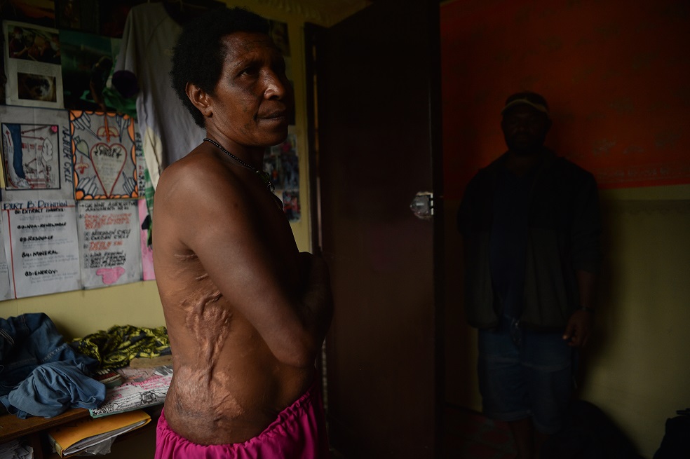 Terror en Papúa Nueva Guinea: maltratan, violan y matan a personas acusadas de brujería
