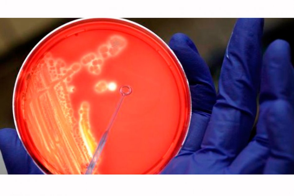Bacterias amenazan salud pública en EE.UU.