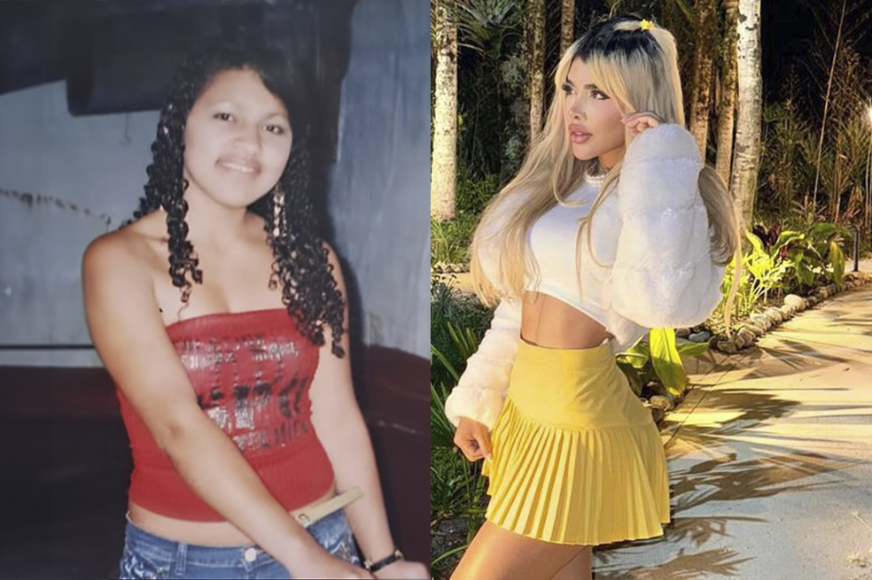La ‘barbie’ colombiana: Quién es, cuántas cirugías tiene, edad y más de la aspirante a LCDLF