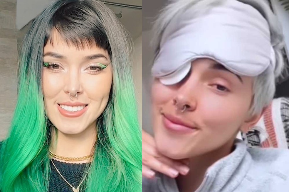 Kika Nieto confesó cómo se dio cuenta del tumor que tiene en uno de sus ojos