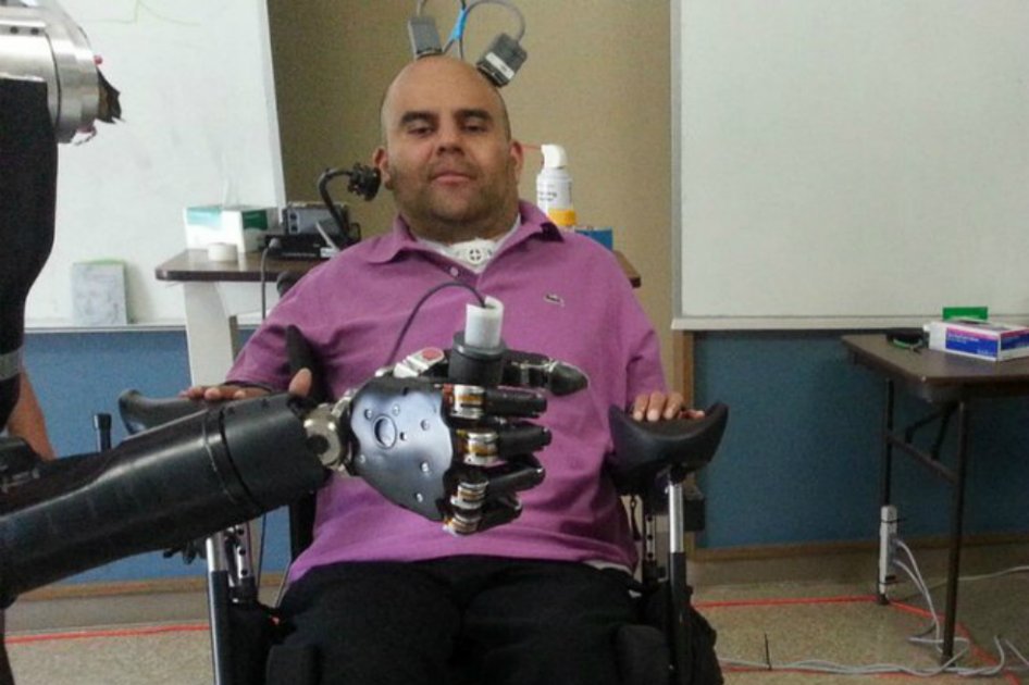 Por primera vez consiguen que un brazo artificial se mueva con el pensamiento