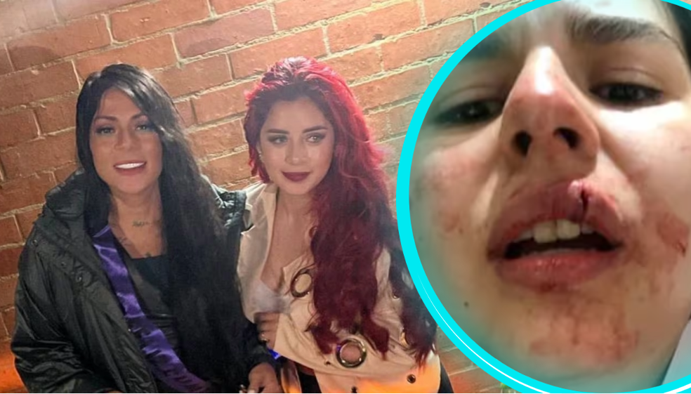 Hija de Marbelle habló de la pelea que tuvo con su vecina: “Me arrastró del pelo”