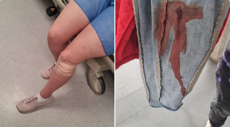 Esposa de concejal de Bogotá fue herida en medio de un robo en TransMilenio
