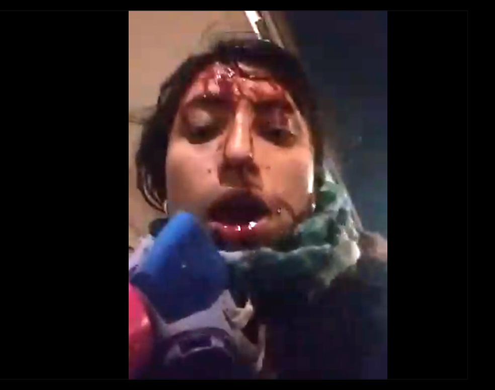 Policías golpearon a una mujer cerca de Uniandes hasta dejarla inconsciente