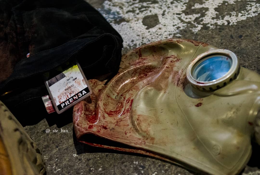 Joven reportero denuncia que fue apuñalado por Policía en Usme