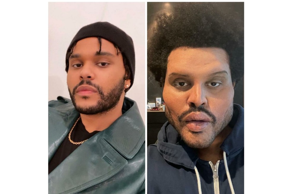 The Weeknd ya había dado indicios de que había entrado al quirófano desde noviembre cuando fue a la gala de los American Music Awards con el rostro vendado.