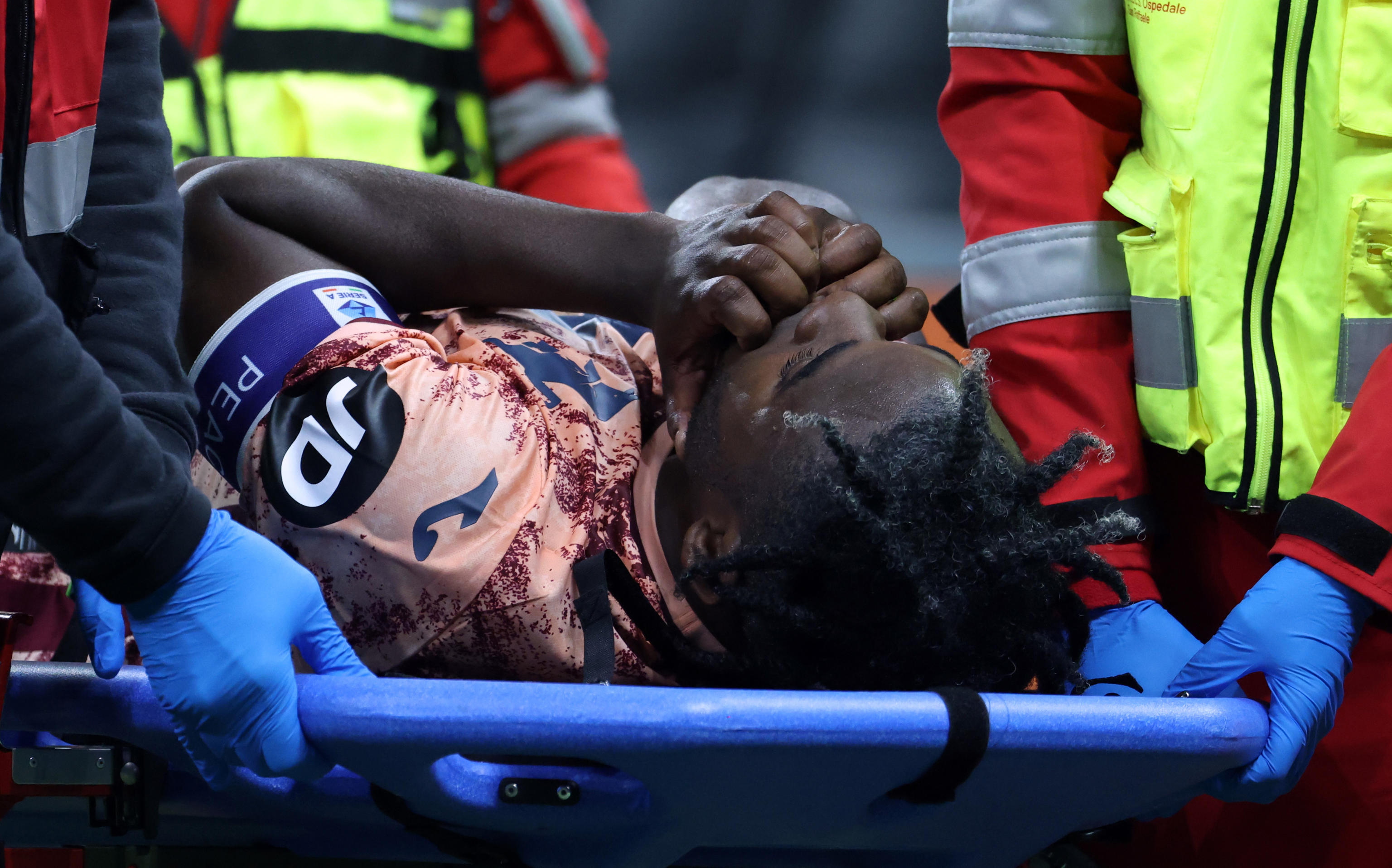 Duván Zapata sufrió terrible lesión y se pierde el resto de la temporada