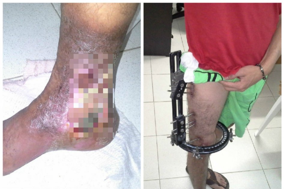 Grave situación en cárceles de Antioquia por suspensión de servicios de salud