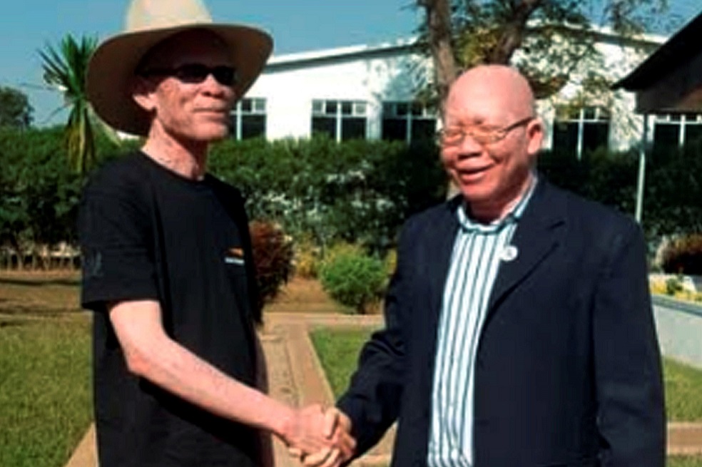 Overstone Kondowe, presidente de APAM, y Steven Burges, candidato al Parlamento de Malawi. / EFE