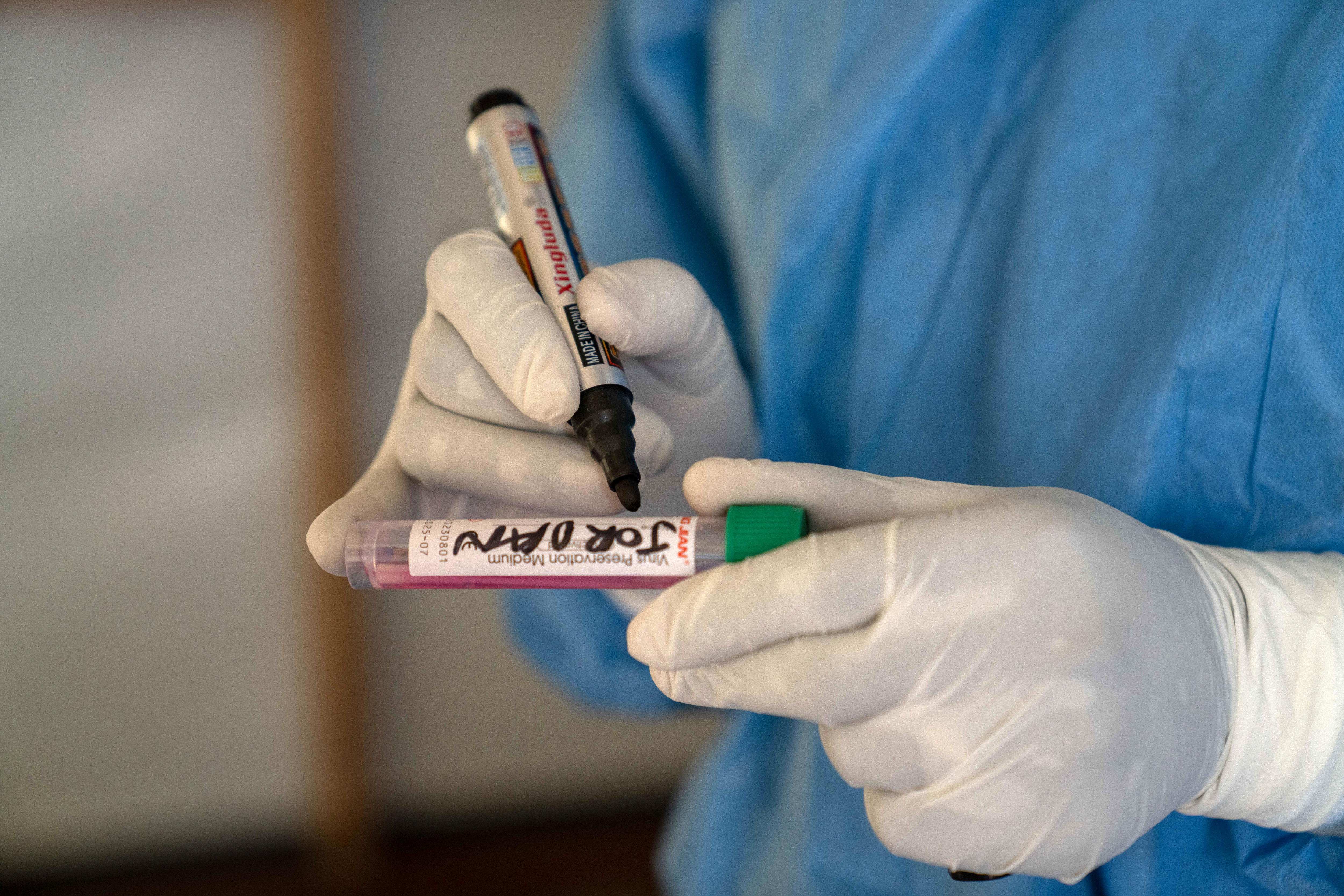 No, ni en Colombia, ni en las Américas, se ha identificado el clado Ib de mpox