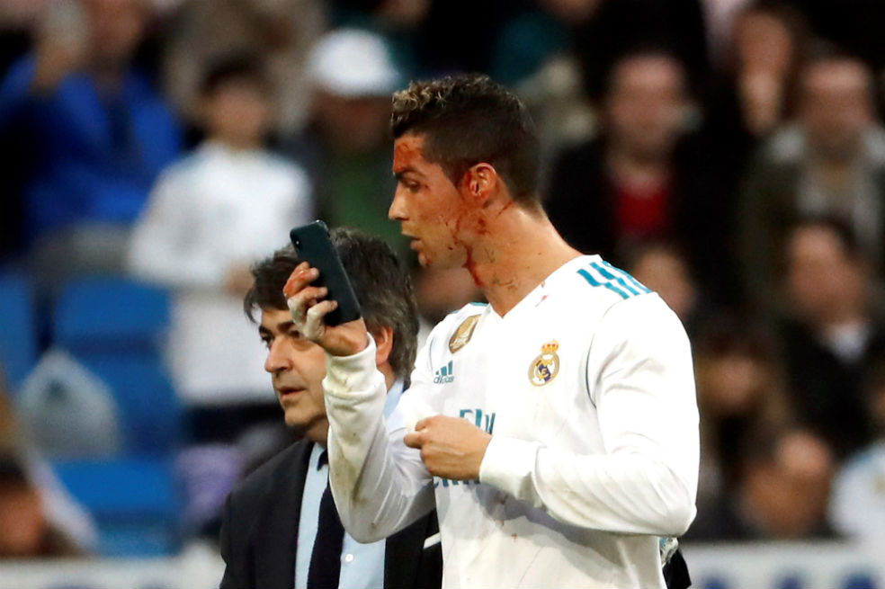 La imagen del día: Cristiano pide un celular prestado para mirarse una herida