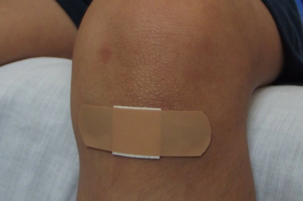 ¿Cómo curar las heridas cotidianas en casa?