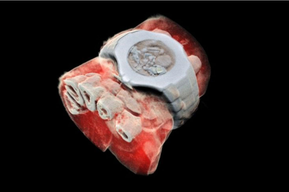 Tecnología de partículas revela los primeros rayos X en color y 3D