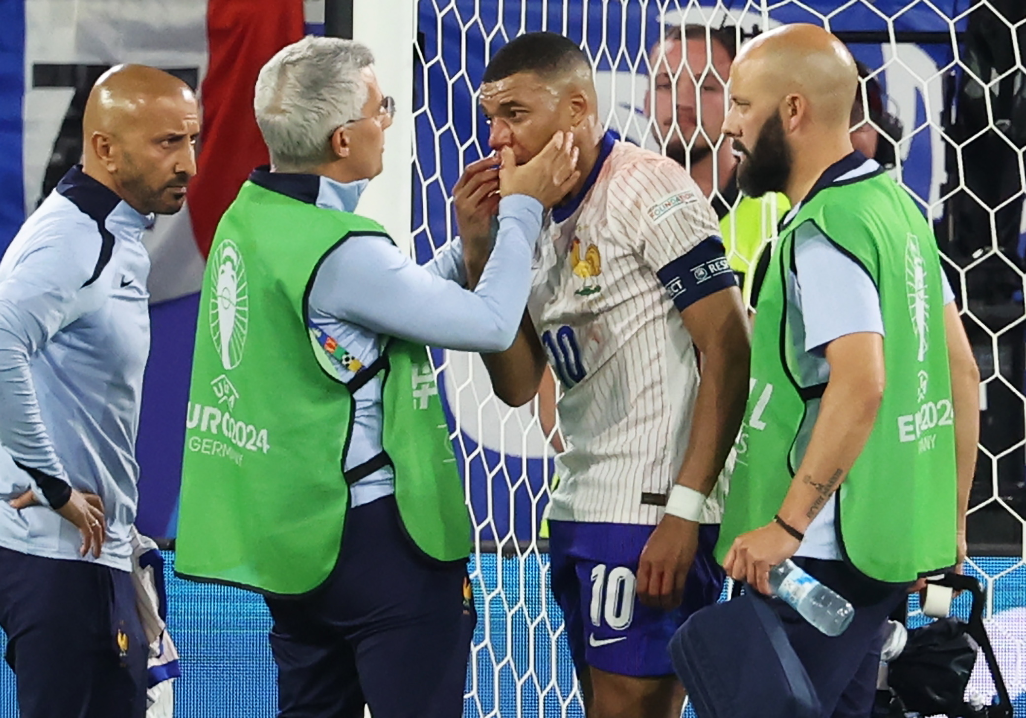 Dusseldorf (Germany), 17/06/2024.- Kylian Mbappe (C) of France receives medical attention during the UEFA EURO 2024 group D soccer match between Austria and France, in Dusseldorf, Germany, 17 June 2024. (Francia, Alemania) EFE/EPA/CHRISTOPHER NEUNDORF