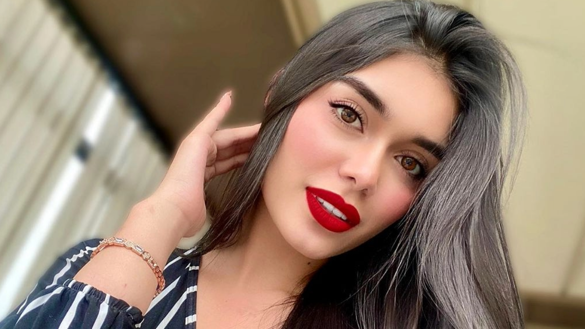 Modelo Jineth Riveros denunció golpiza de su expareja por cobrarle vieja deuda
