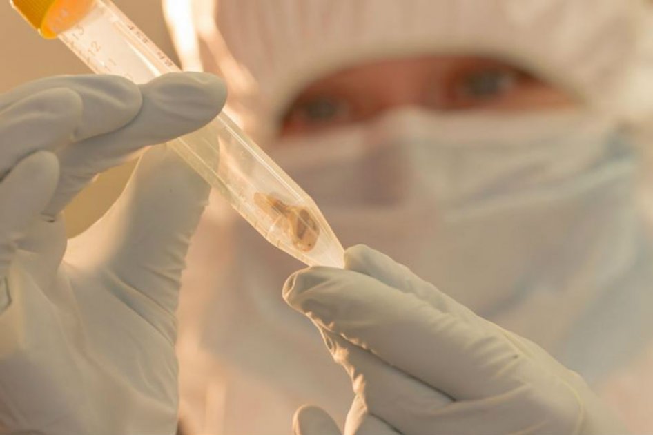 Los investigadores obtuvieron el ADN bacteriano de los dientes de dos víctimas de la peste./ McMaster University