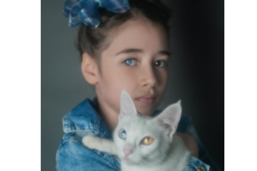 Esta anomalía hace que el color de los ojos sea diferente. Descubre más aquí.