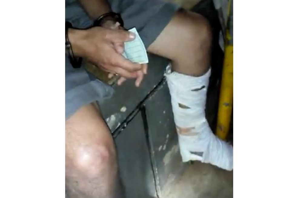 En Bucaramanga joven simulaba estar fracturado y en el yeso camuflaba droga
