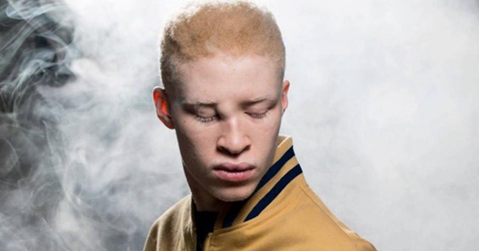 Shaun Ross, el primer albino en pisar una pasarela