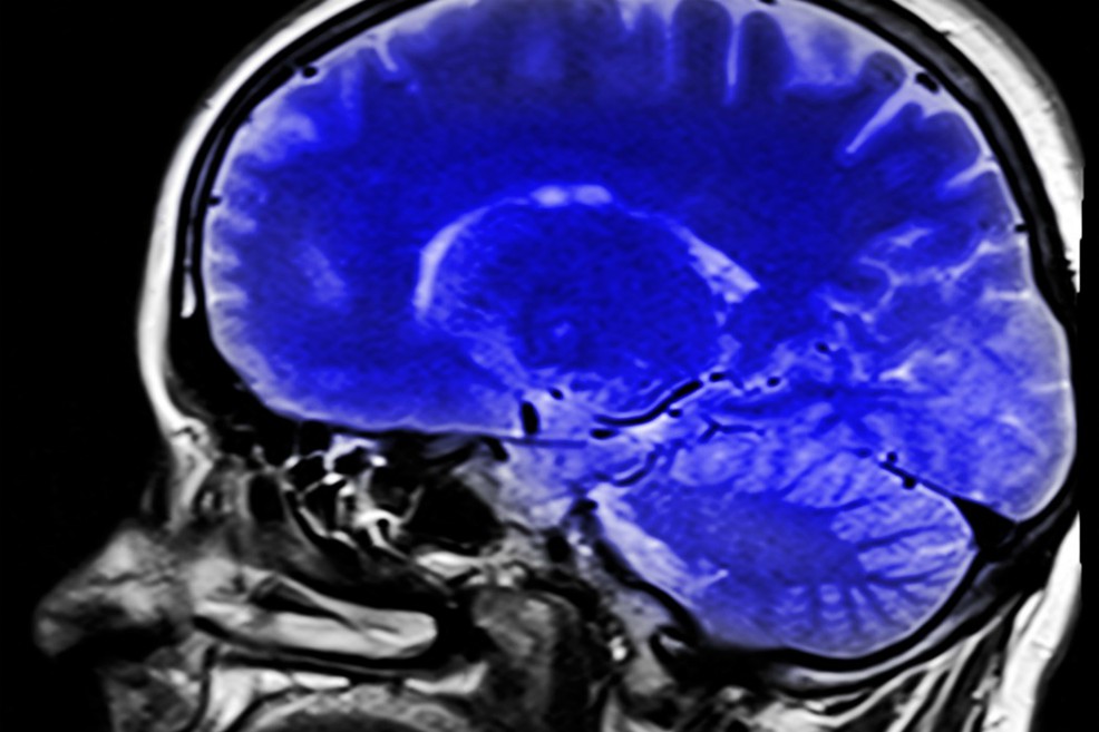 Así cambia el “cableado” cerebral del mono y el humano