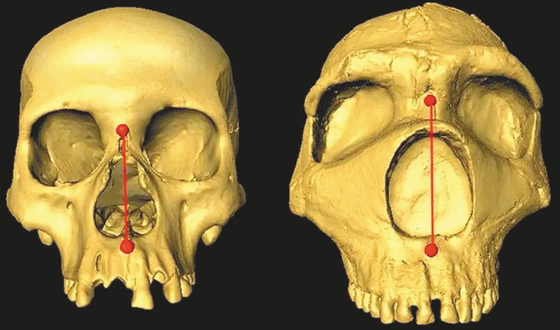 ¿Qué determina la forma de nuestra nariz? Encuentran pistas en genes neandertales