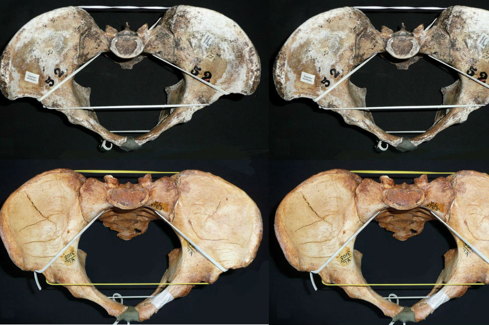 La diferencia entre canales vaginales cuestiona una antigua teoría evolutiva