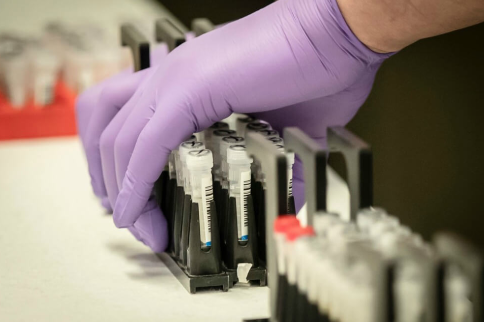 Supersalud alerta por pruebas de COVID-19 represadas y escasez de insumos en los laboratorios