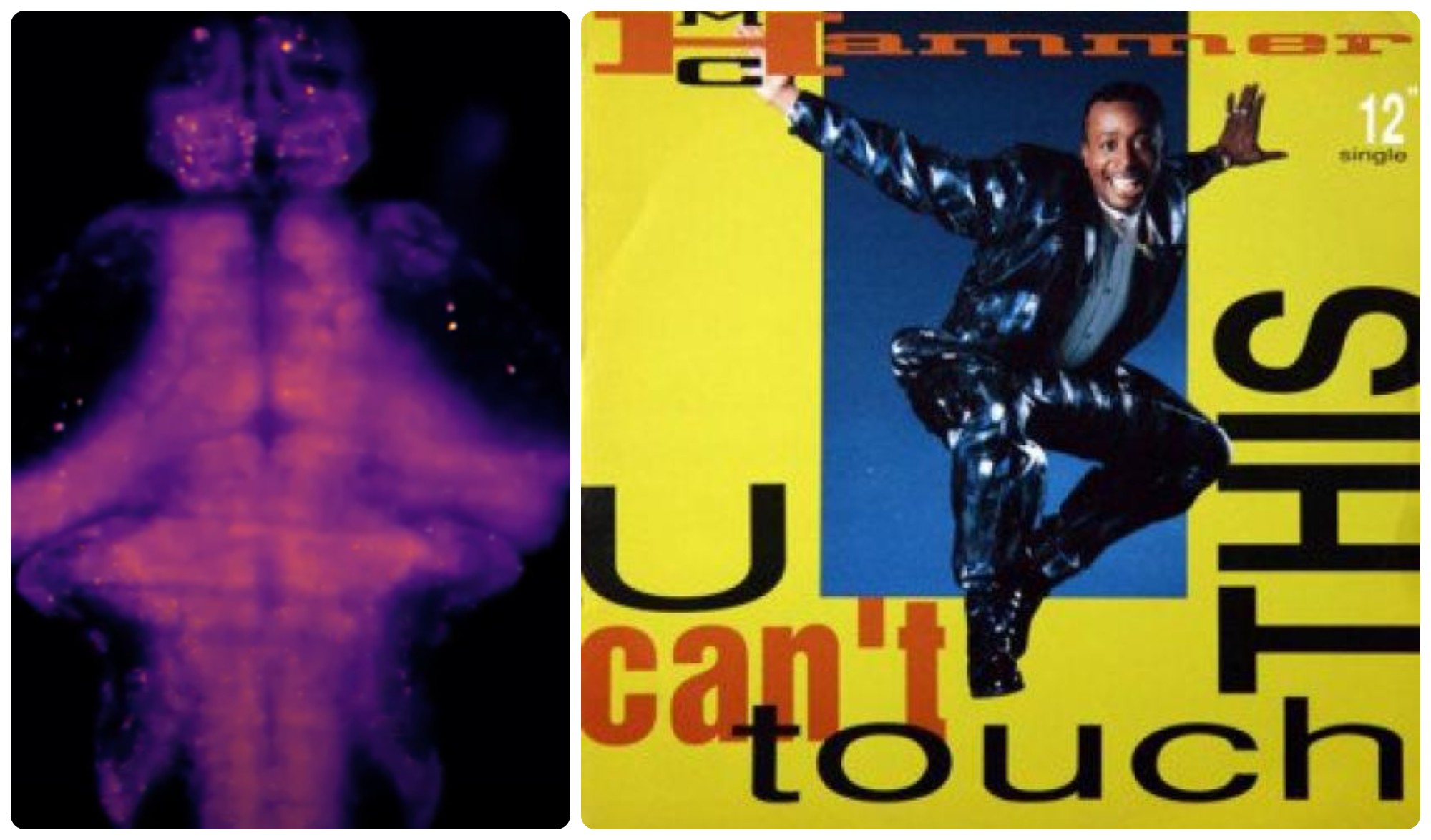 Así reacciona el cerebro de un pez bebé al escuchar la canción U can’t touch this (video)