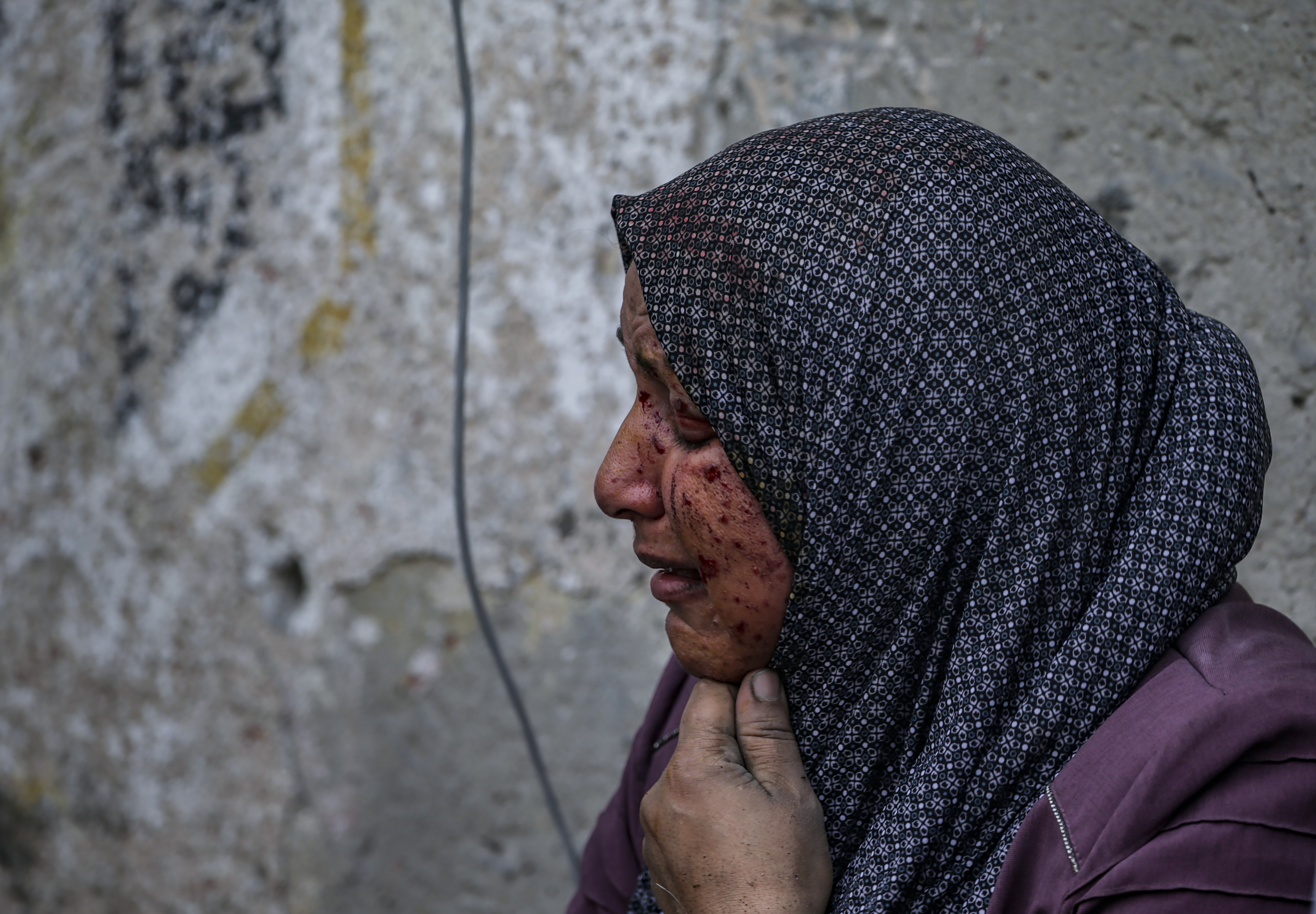 Gaza City (---), 23/10/2023.- An injured Palestinian woman weeps after losing her son in Israeli air strikes on Gaza City, 23 October 2023. More than 4,700 Palestinians and over 1,400 Israelis have been killed, according to the Israel Defense Forces (IDF) and the Palestinian health authority, since Hamas militants launched an attack against Israel from the Gaza Strip on 07 October. EFE/EPA/MOHAMMED SABER