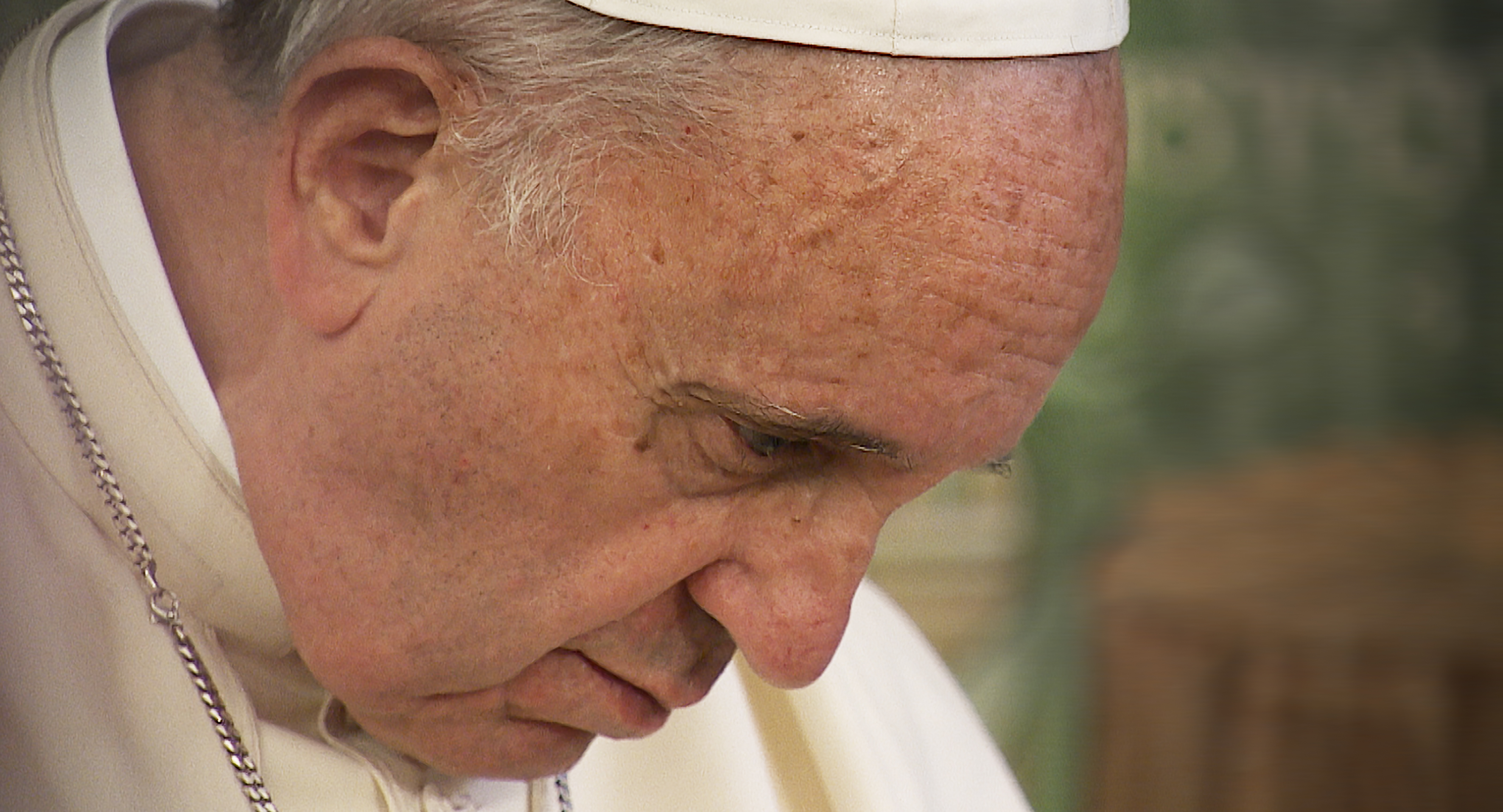 Papa Francisco permanecerá varios días hospitalizado por infección respiratoria