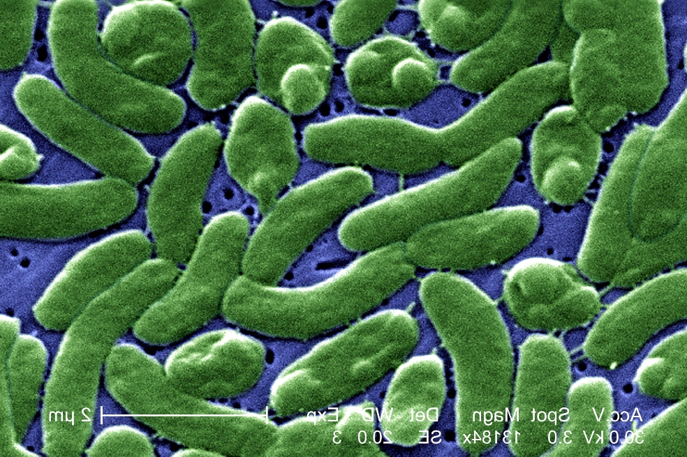 Calentamiento global ayudaría a expandir a esta bacteria que preocupa a científicos