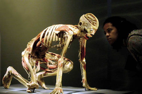 Regresa a Bogotá «Bodies», la exposición con cuerpos humanos reales