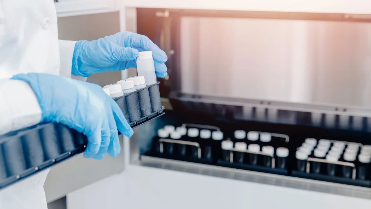 Un tribunal le prohibió a un hombre donar más esperma tras engendrar 550 hijos