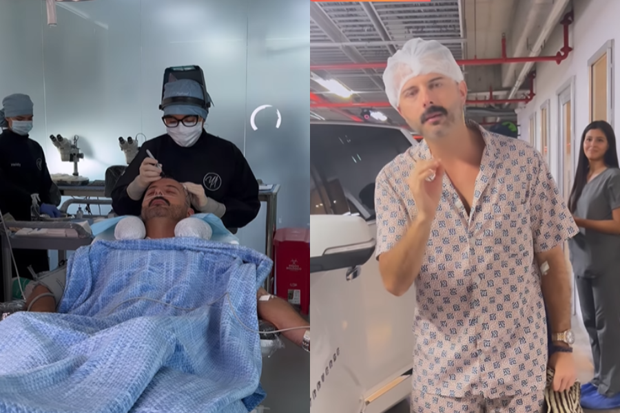 Video | Mario Espitia se puso implante de cabello y así quedó