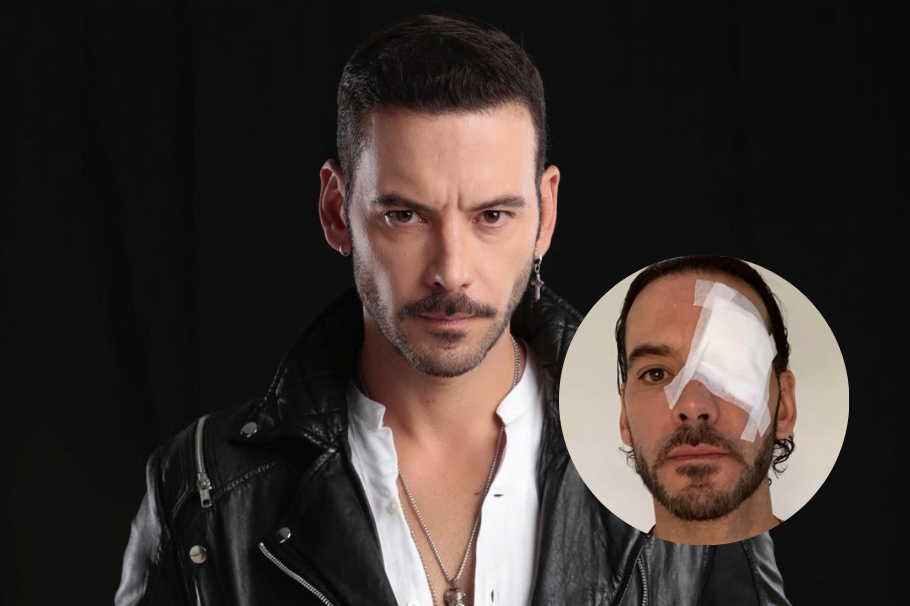 ¡Diego Cadavid tuvo fuerte accidente! “Me rompí la cabeza”, dijo el actor