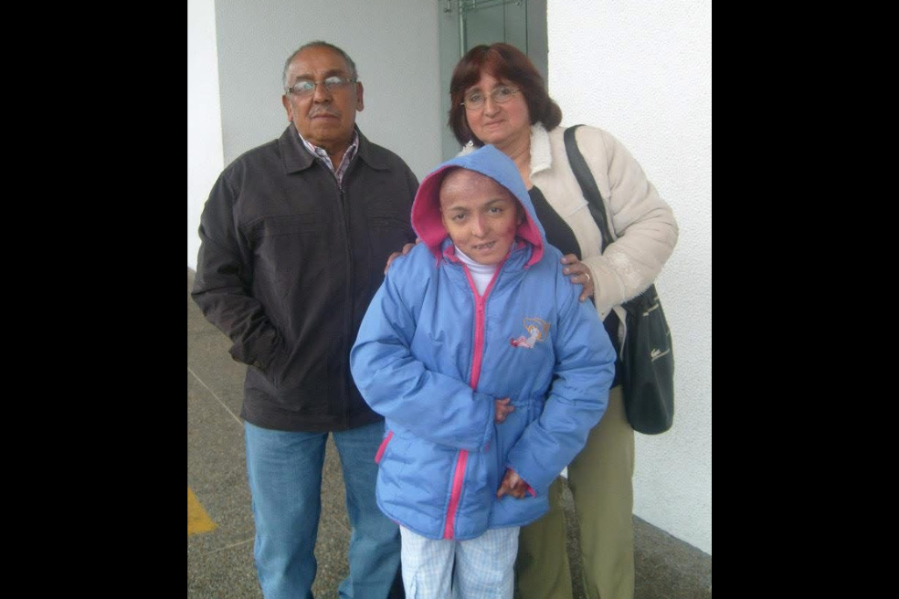 CIDH aprueba acuerdo por el caso de Jessica Ramírez, paciente con piel de mariposa