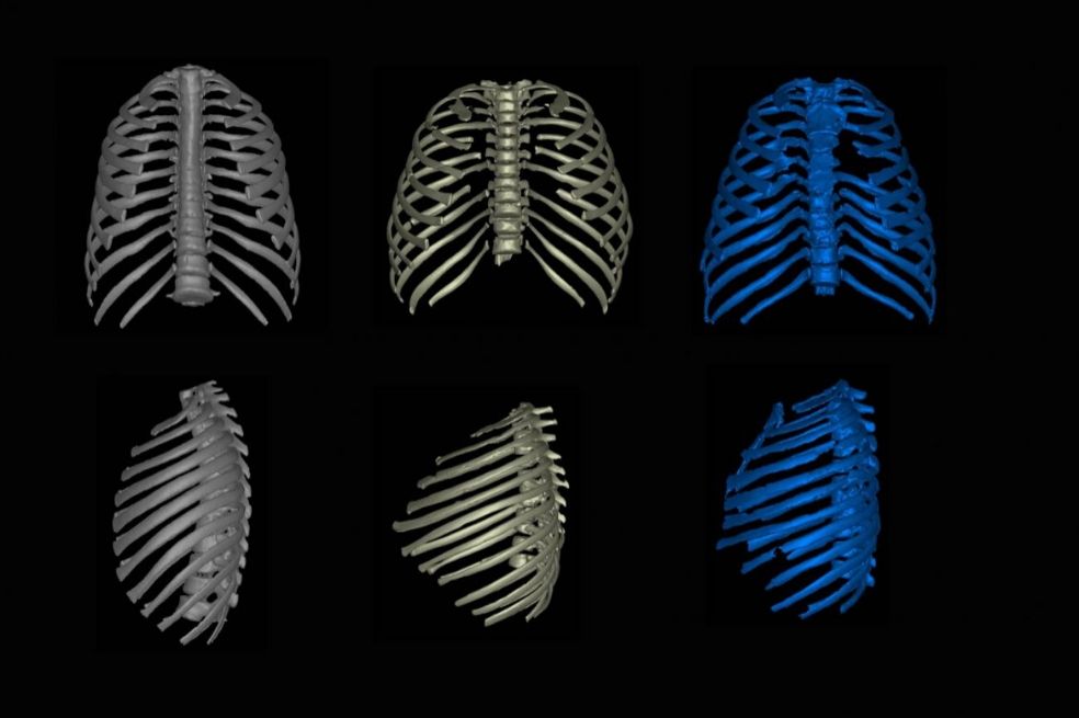 Comparativa de las cajas torácicas de un ser humano moderno, un erectus y un neandertal.
